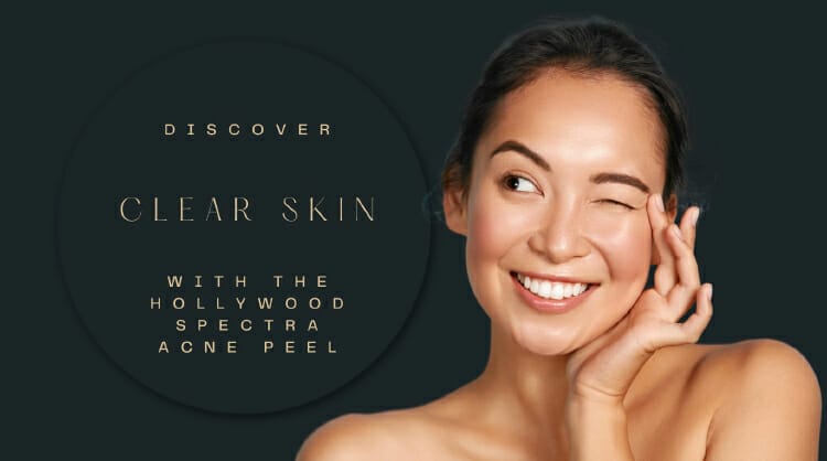 Discover clear skin with the Hollywood spectra acne peel